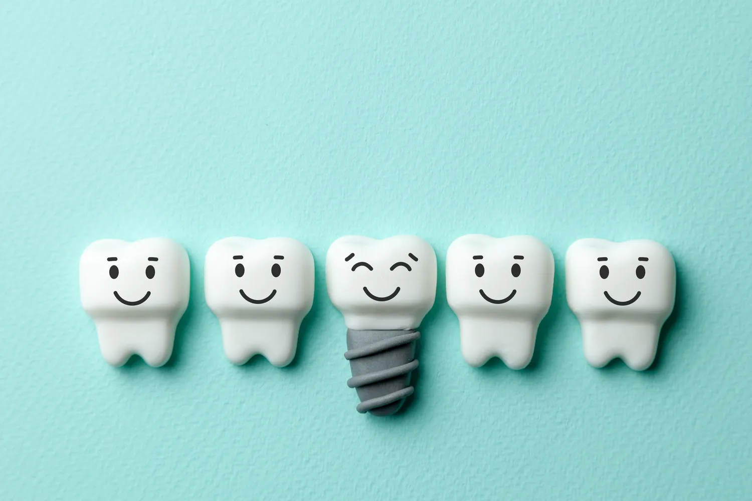 Implanty zębowe - powiew przyszłości w gabinecie dentystycznym